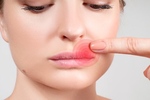 Herpes Hilfe Herpes Hilfe