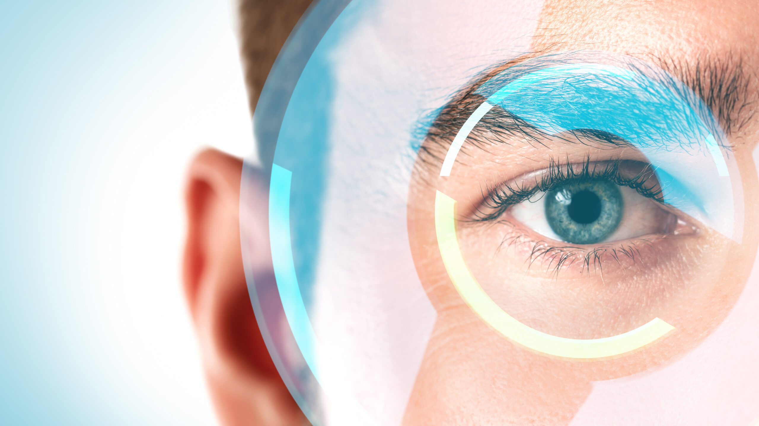 Nahaufnahme eines Auges mit grafischer Darstellung einer Augenlaserbehandlung.